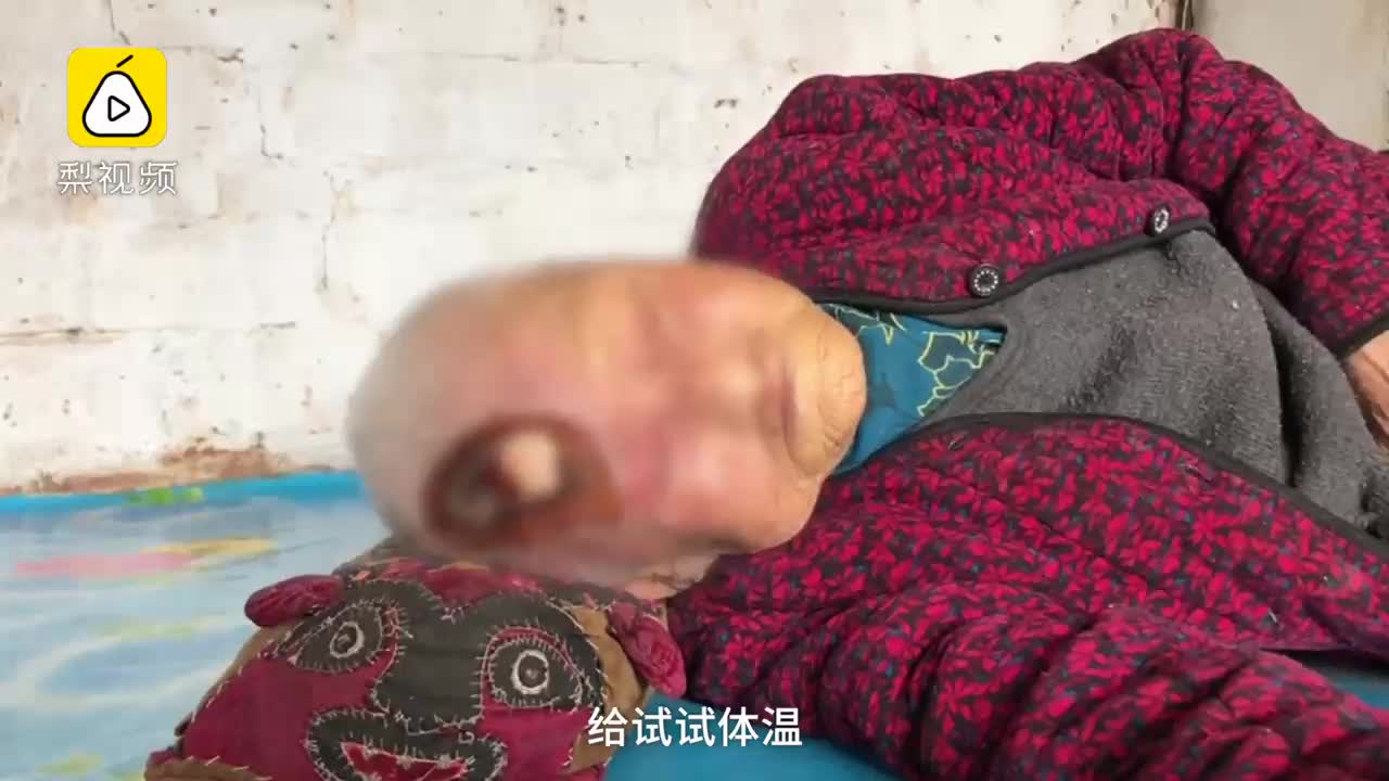 [视频]106岁老太磕破头 越抠越破露出白骨