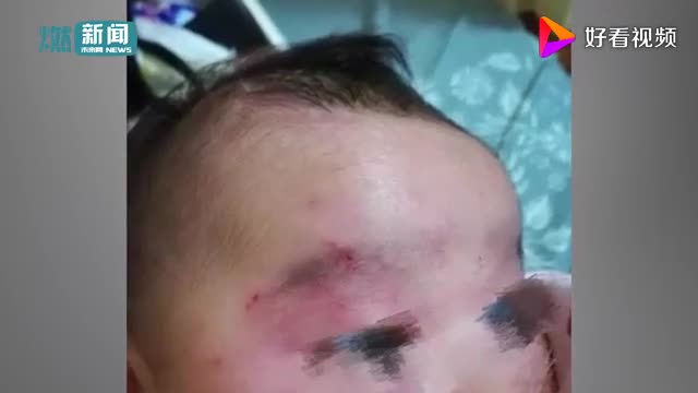 [视频]未满月儿子遭4岁侄女暴打 