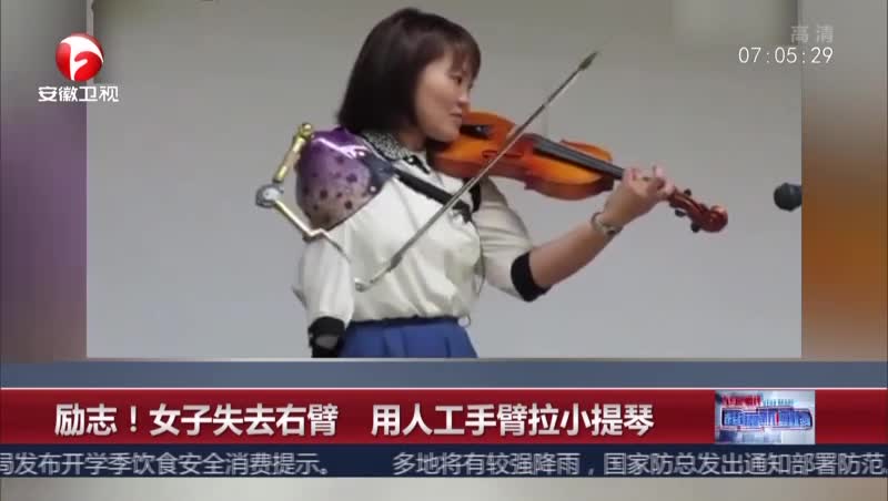 [视频]励志！女子失去右臂 用人工手臂拉小提琴