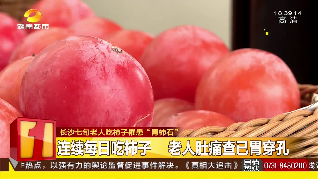 长沙七旬老人吃柿子罹患“胃柿石”