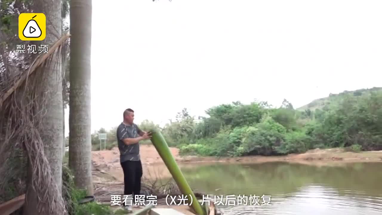 [视频]少年钓鱼被树叶砸伤，竟要开颅抢救